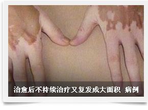 人